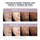Eucerin Anti-Pigment Crema Facial de Día FPS 30